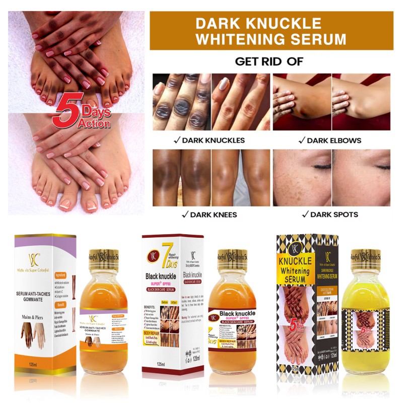 Wholesale Dark Finger Joint Remover Whitening Serum Finger Joint Blacking Moisturizing Skin Brightening Essence