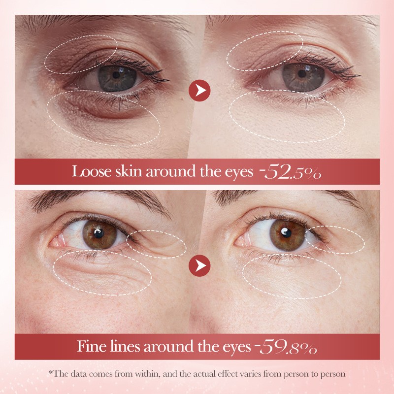 Hot Selling Private Brand Snail Pouch Removing Cream Anti-wrinkle Tight Dark Circles Removing Tight Eye Cream