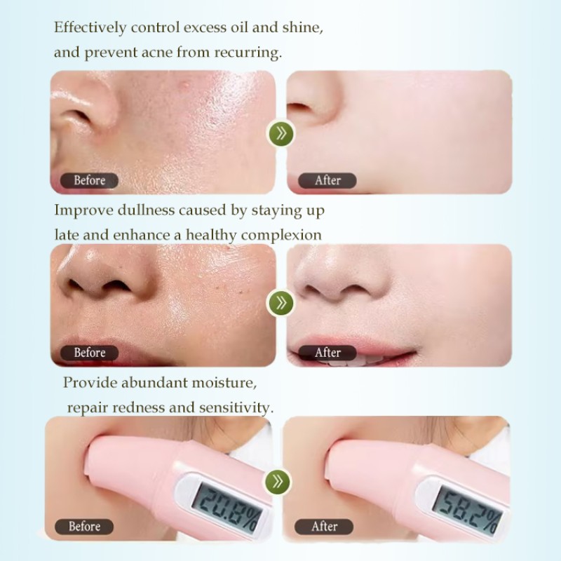 Moisturizing Lotion Supplier - Bleach Firming Home Use