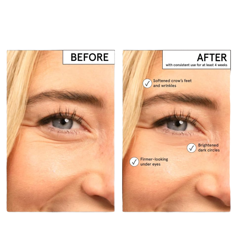 Eye Balm Supplier - Brightener Niacinamide Caffeine