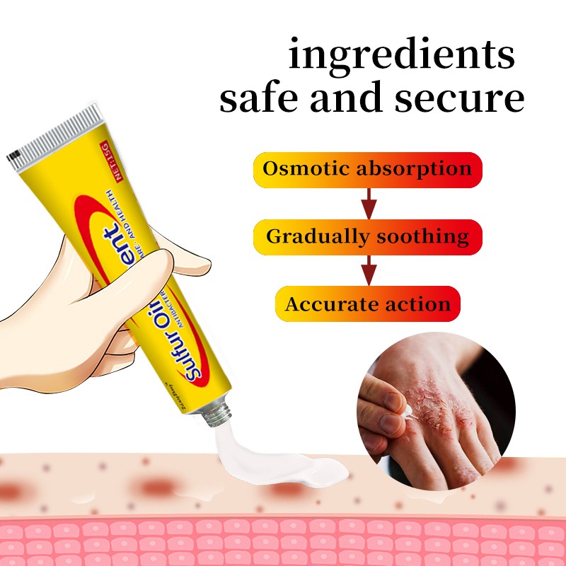 Antifungal Ointment Manufacturer - Sulfur Mite Cream