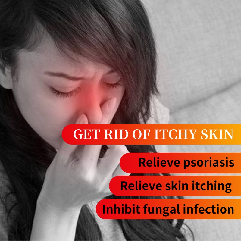 Rhinitis Cream Manufacturer - Allergy Itch Relief