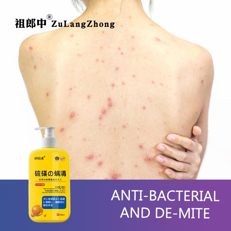 Nasal Strips Supplier - Stop Snoring Breathing