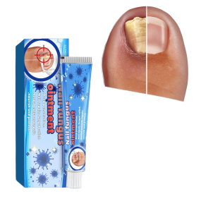 Knee Ointment Manufacturer - Synovial Meniscus Pain