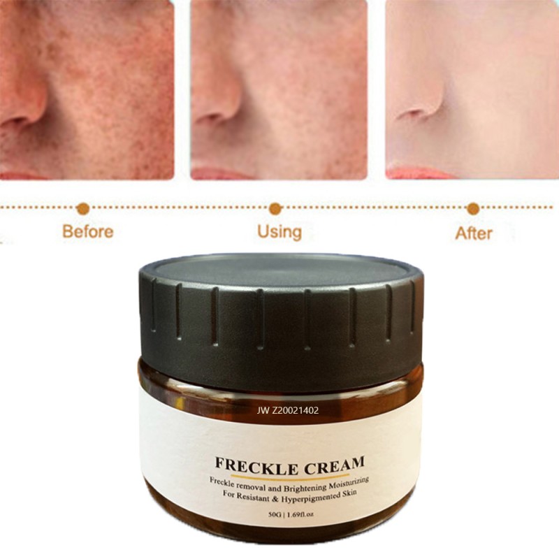 Freckle Cream Supplier - Face Acne Melasma Removal
