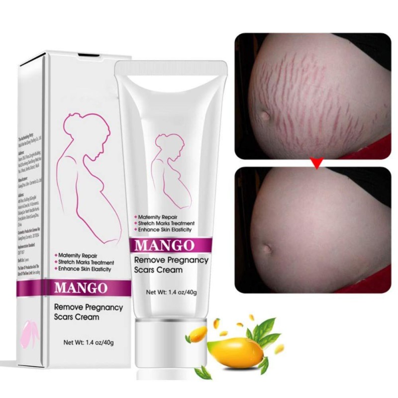Stretch Mark Cream Supplier - Pregnancy Scar Removal