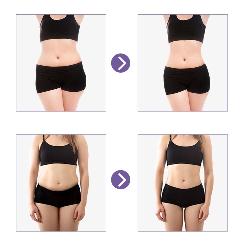 Stretch Marks Cream Factory - Pregnancy Scar