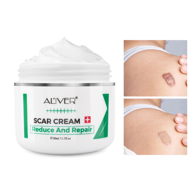 Acne Scar Cream Manufacturer - TCM Formula