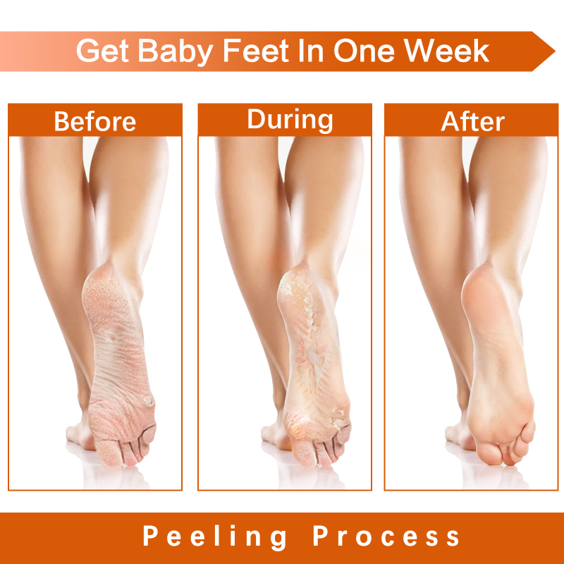 Chamomile Foot Mask Factory - Moisturizing