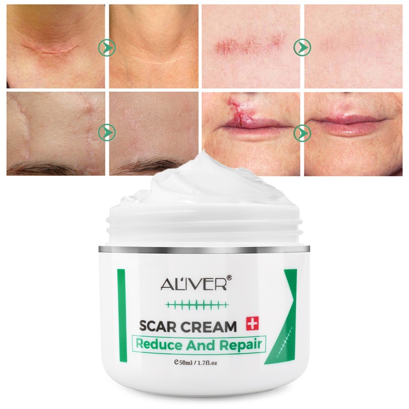 Acne Scar Cream Manufacturer - TCM Formula