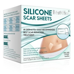 Silicone Patch Supplier - Gel Remover OEM