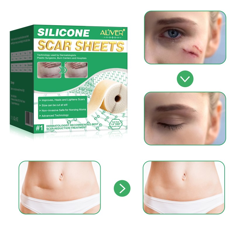 Keloid Scar Patch Factory - Stretch Marks