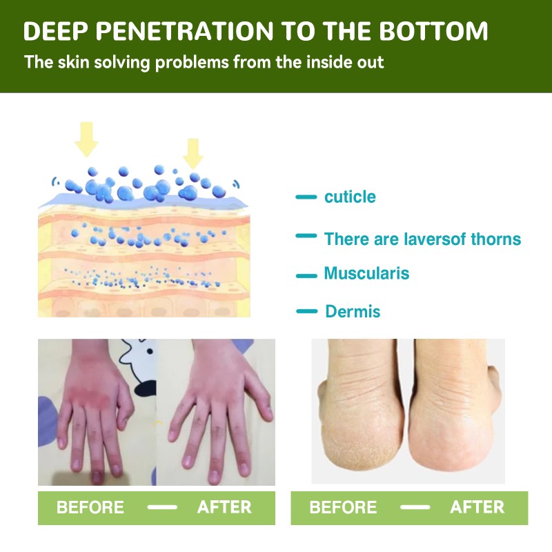 Foot Care Cream Factory - Herbal Crack Repair Moisture