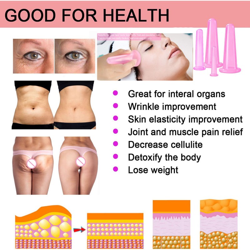 Facial Cupping Cups Manufacturer - 4PCS Anti-cellulite Bank