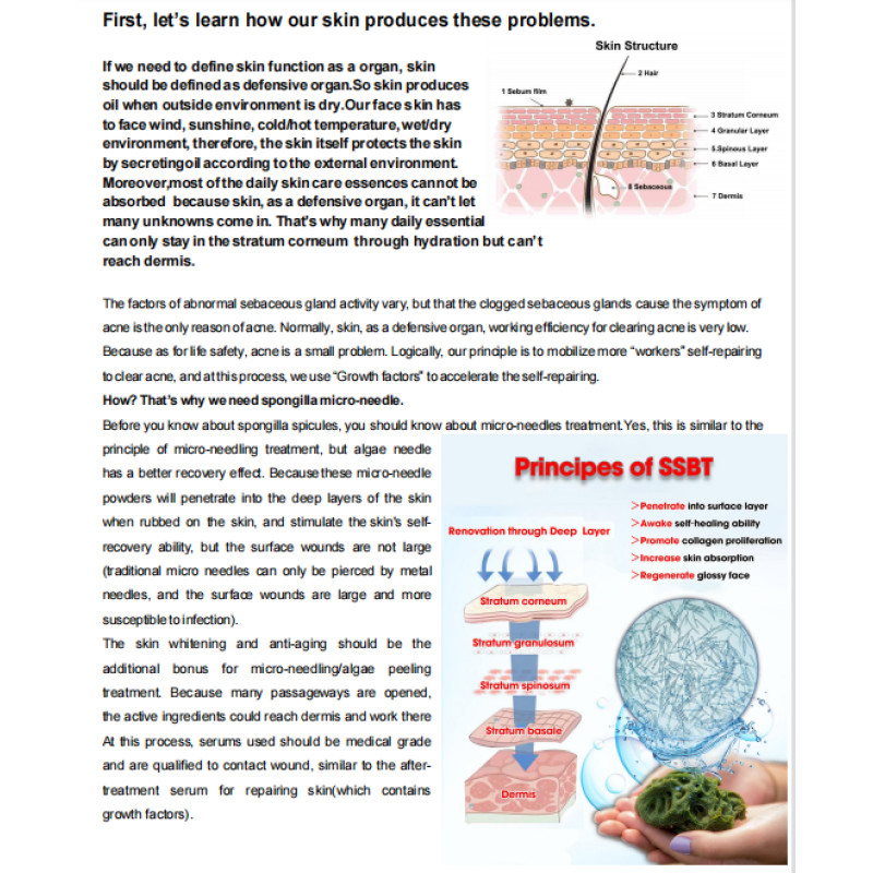 Green Powder Supplier - 20% Spongilla Sponge Spicules