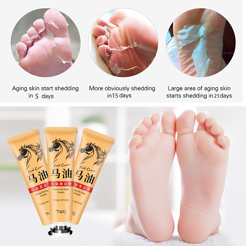 Horse Oil Cream Supplier - Anti Crack Callus Removal