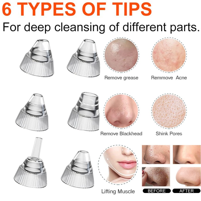 Pore Cleaner Manufacturer - Blackhead Remover Vacuum Camera