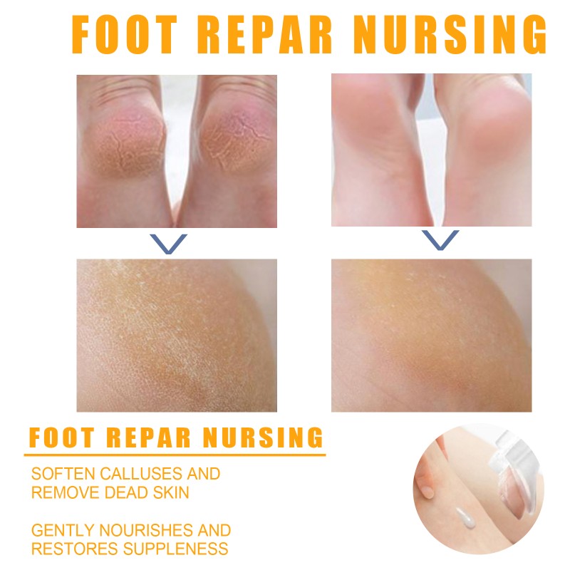 Foot Peeling Spray Manufacturer - Natural Orange Essence