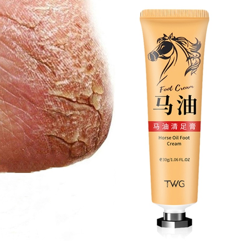 Horse Oil Cream Supplier - Anti Crack Callus Removal