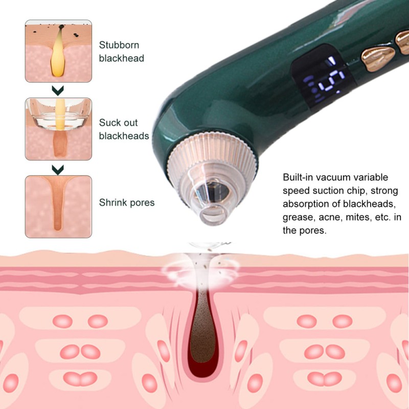 Pore Cleaner Manufacturer - Blackhead Remover Vacuum Camera