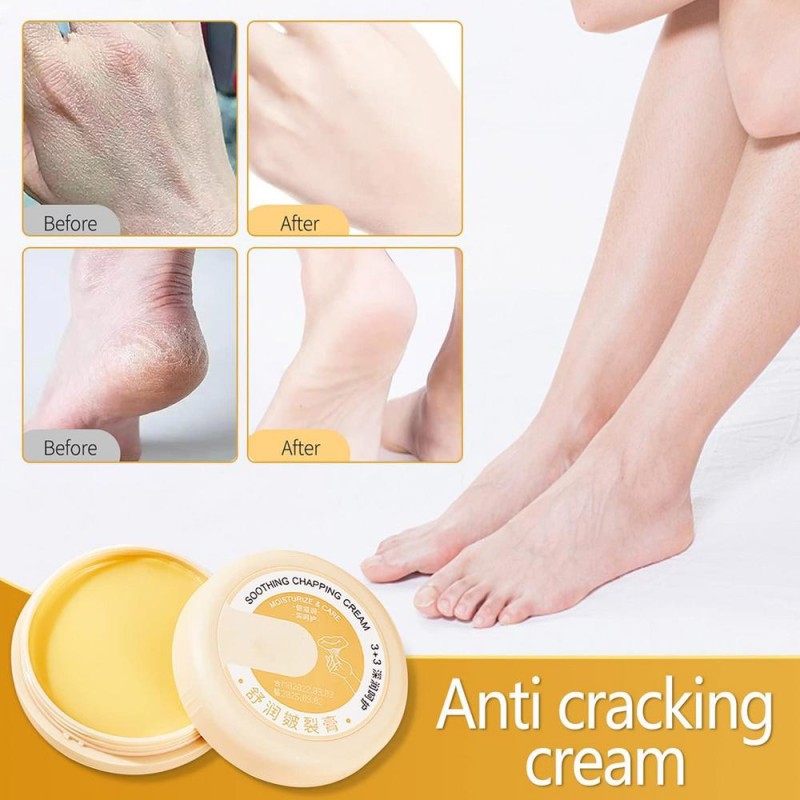 Skin Repair Cream Supplier - 20g Anti Cracking Nourishing