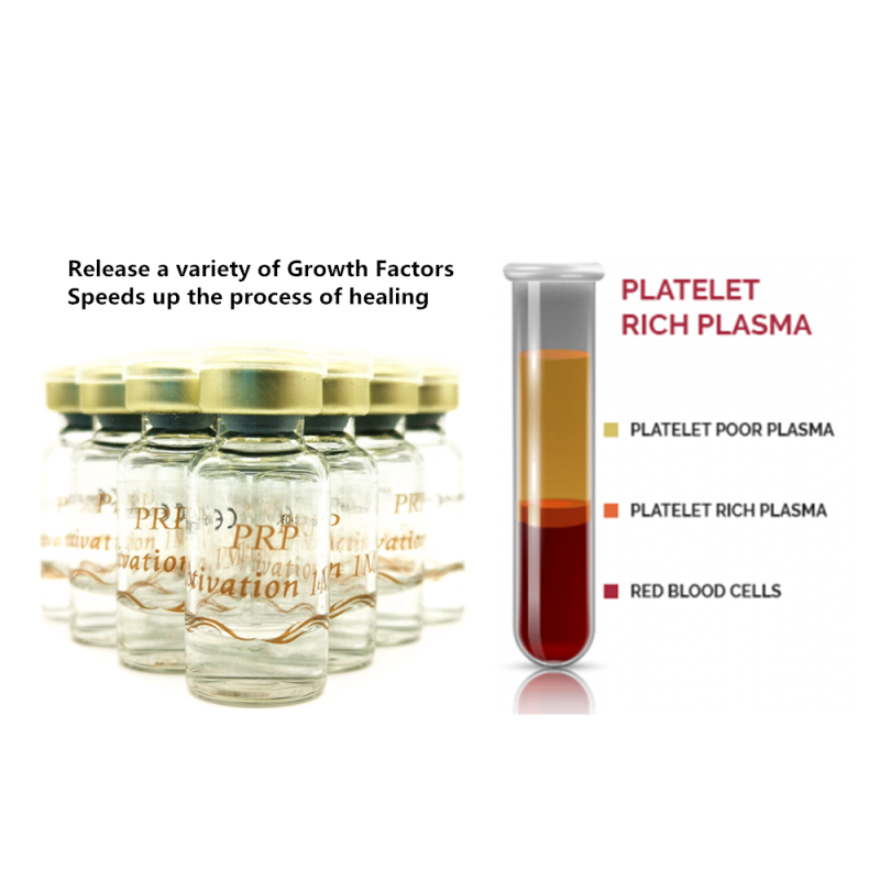 PRP Activator Supplier - Hot Sale OEM Custom