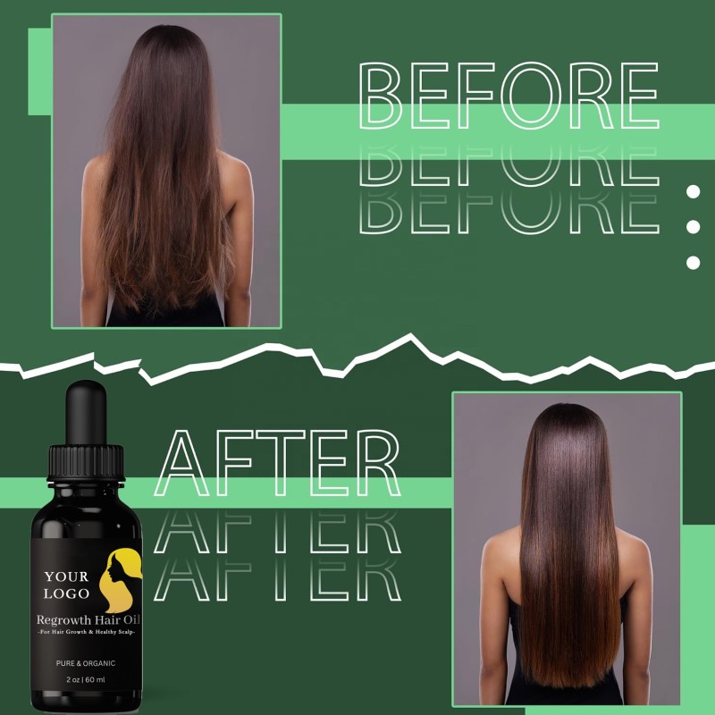 Taramira Oil Supplier - Hair Growth Stimulant