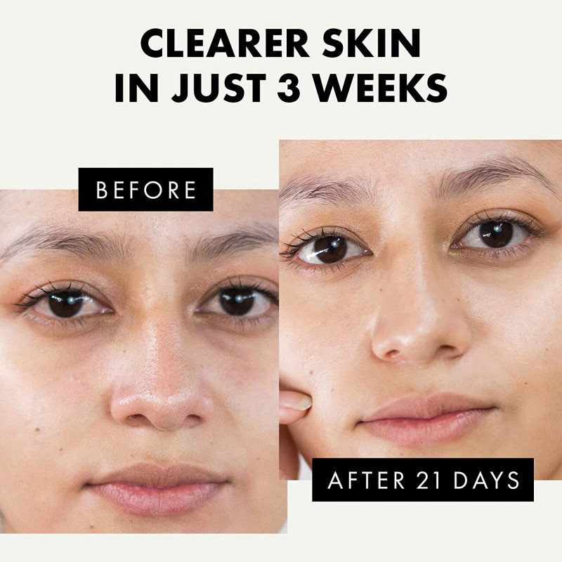 Brightening Face Wash Supplier - Niacinamide Gel