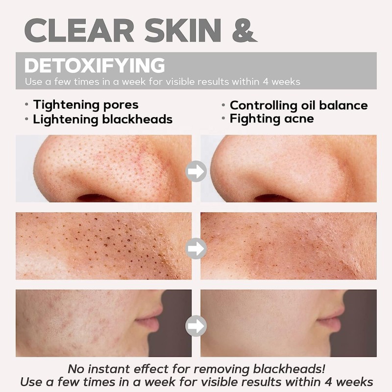 Charcoal Mask Manufacturer - Bubble Clay Detox