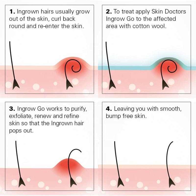 After Shave Solution Supplier - Waxing Care