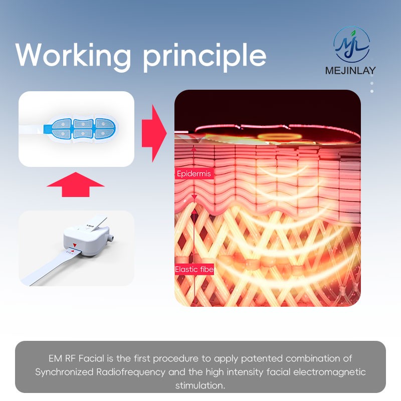 RF Facial Device Factory - Portable Anti Aging Custom