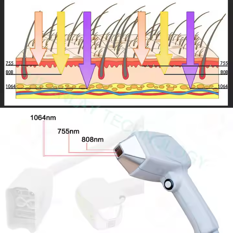 Diode Laser Machine Manufacturer - 808 Titanium Laser