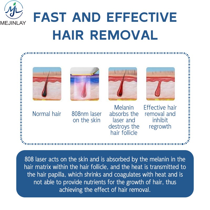 Ice Laser Machine Factory - 808 810nm Diode Professional