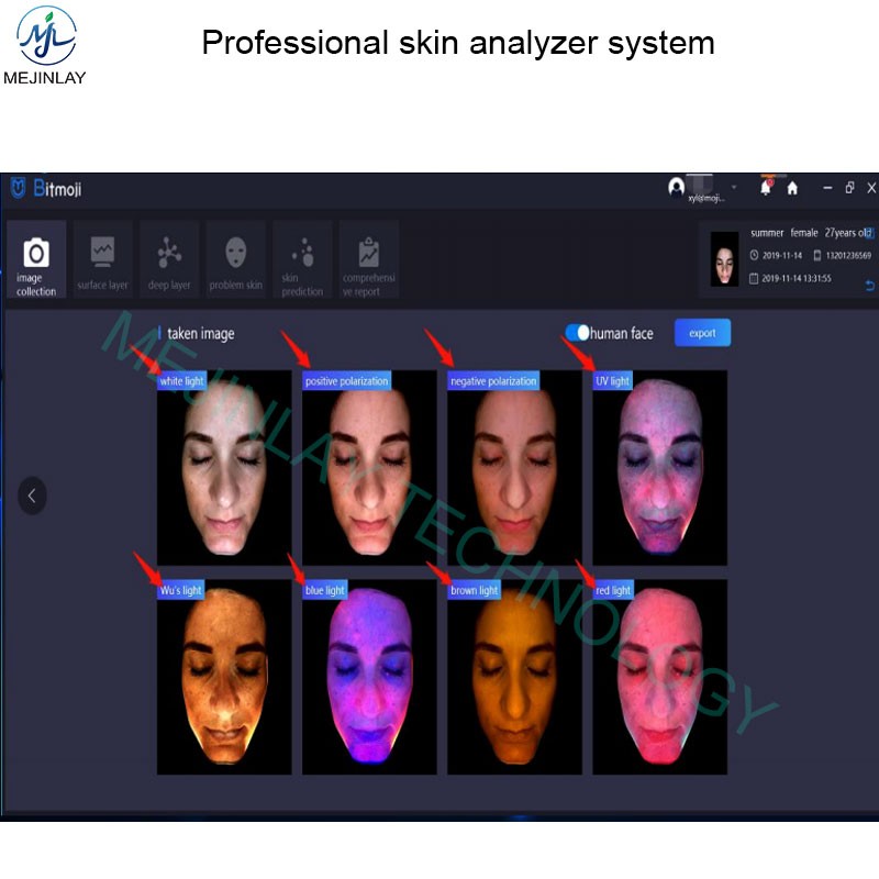 RF Face Massager Manufacturer - Thermal Tripolar Lifting