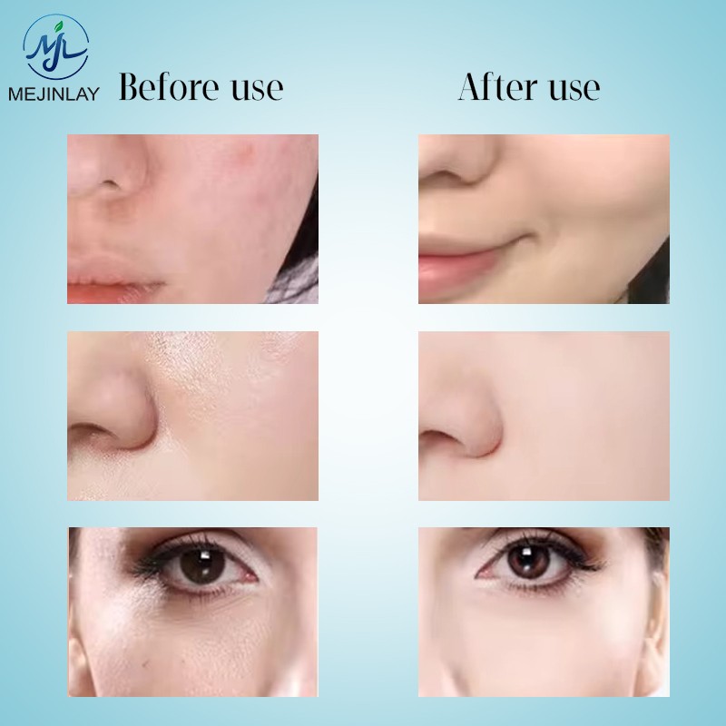 Beauty Device Factory - 7 Colors LED Pigment Removal