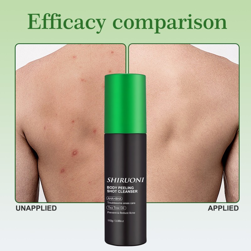 Wholesale Body Mist Calming Moisturizing Reduces Acne Controls Oil Tea Tree Oil Wholesale Body Spray for Men