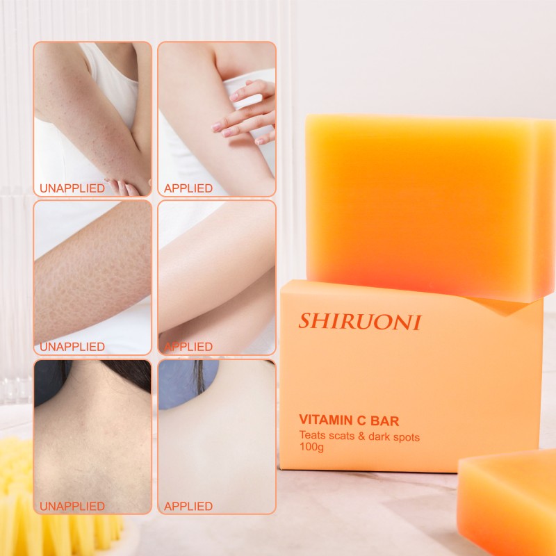 Wholesale Turmeric Soap Private Label Wholesale Gentle Cleansing Acne Removal Body Whitening Turmeric and Honey Soap