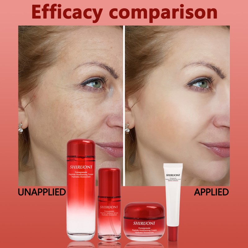 Private Label Face Cream Toner Hydrating Anti Wrinkle Moisturizing Pomegranate Anti Aging Skin Care Set