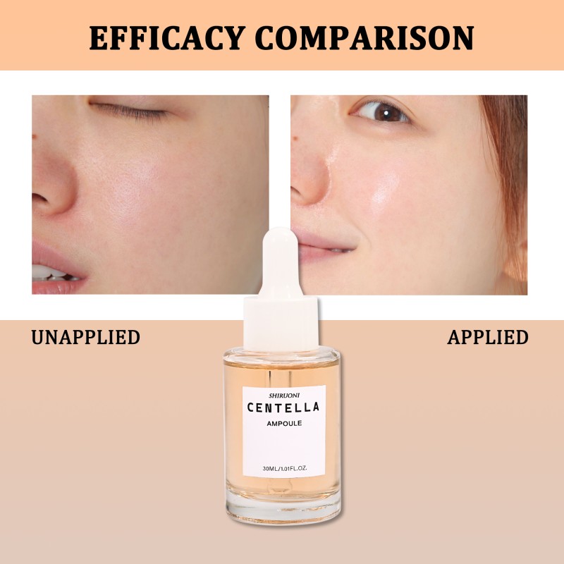 Custom Face Centella Ampoule Skin Serum Kit Relief Acne Brightening Tightening Tea Tree Centella Serum
