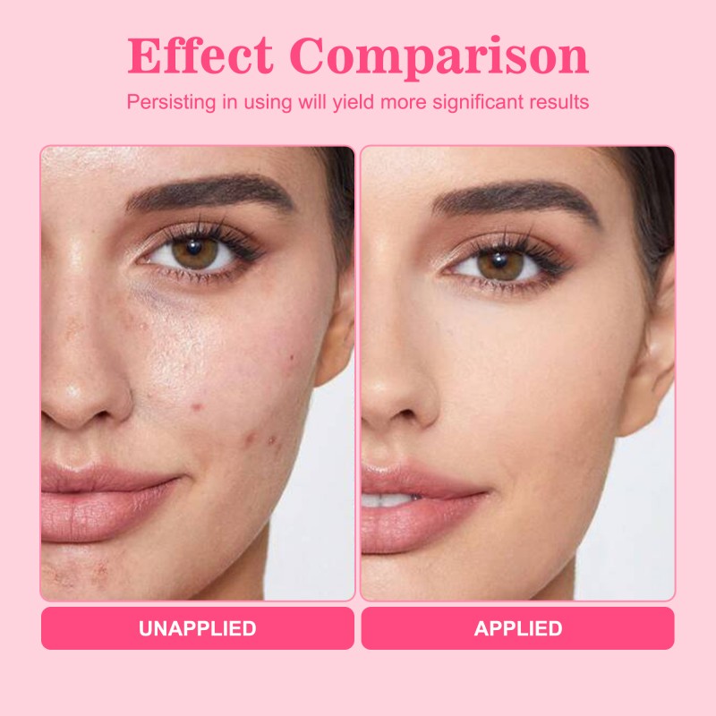 Custom Pdrn Jelly Cleanser Smaller Pores Remove Makeup Anti Acne Foaming Whitening Face Cleansing Gel for Men Women