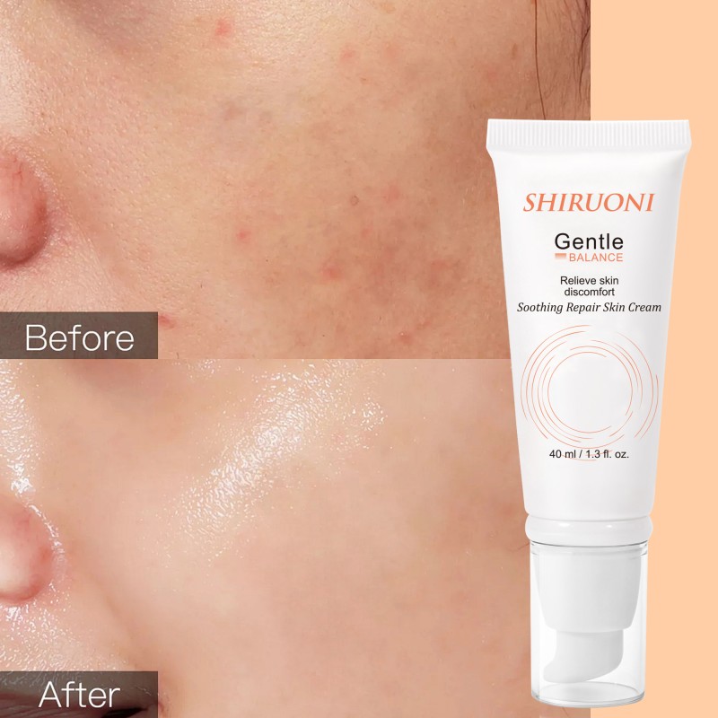 Custom Moisturizing Cream Long-Lasting Lightening Hydration Reduces Redness Citric Acid Soothing Repair Skin Cream