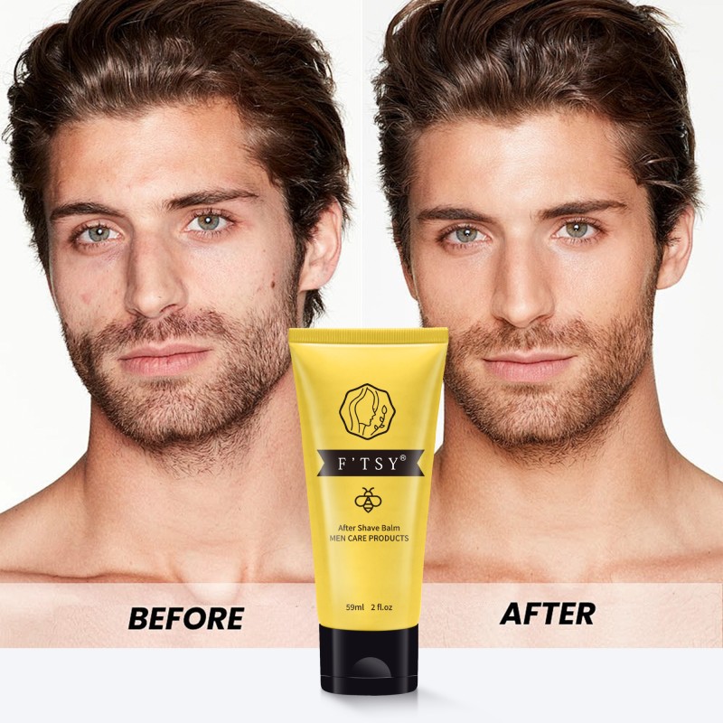 No Burn No Bumps Immediately Calms Private Label Soothes Damaged Skin After Shave Balm Men Care Barber Aftershave