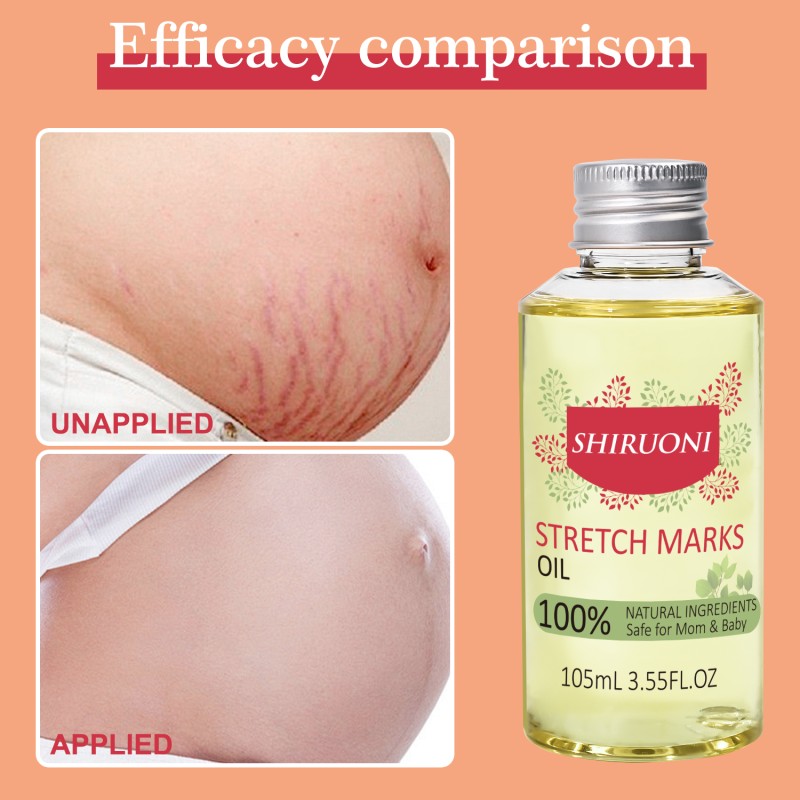 Free Sample Pregnancy Care Moisturizing Nourishing Repair Body Scars Anti Stretch Mark Removal Oil