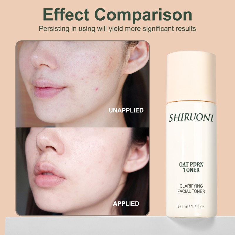 Free Samples Facial Toner Pores Shrinking Ph Balance Long-Lasting Hydrating Oat Pdrn Brightening Toner