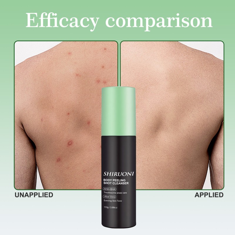 Private Label Body Spray Gentle Exfoliation Deep Hydration Aha Bha Aloe Oem Men Body Spray