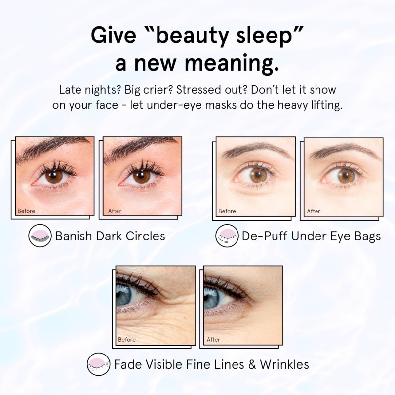 Wholesale Face Care Fade Fine Lines Wrinkles Dark Circles Eye Bags Hyaluronic Acid Under Eye Mask Patches