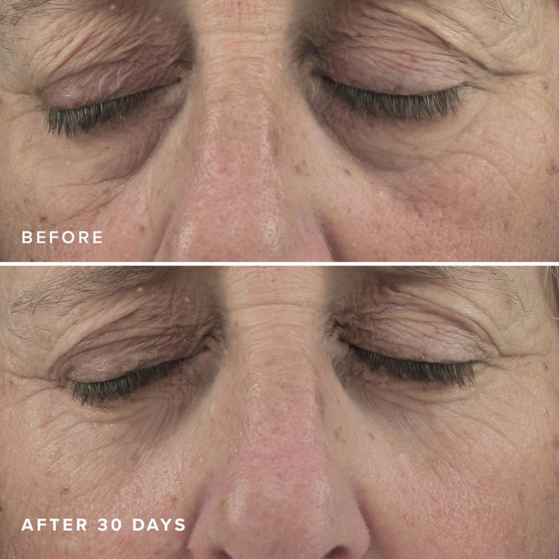 Custom 30 Pairs Eye Patches for Dark Circles Brightening Hyaluronic Acid Under Eye Mask Patch Caffeine