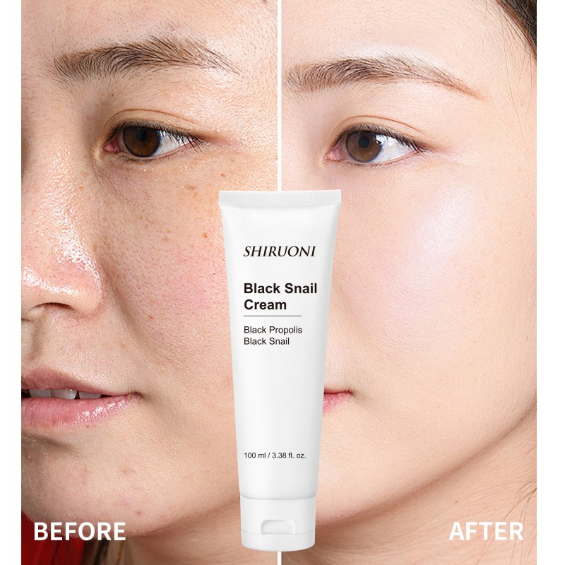 Custom Facial Snail Mucin Cream for Dark Spot Gentle Exfoliation Repairing Brightening Moisturizing Black Snail Cream