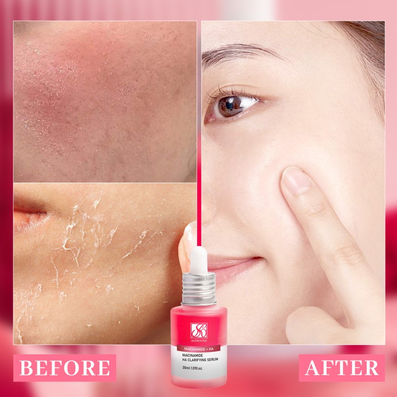 30Ml Niacinamide Txa4 Dark Spots Repairing Moisturizing Lightening Hydrating Face Serum