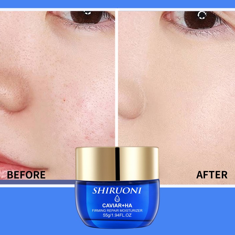 Custom Deep Cleaning Cleanser Moisturizing Toner Eye Cream Moisturizer Caviar Skincare Anti Aging Skin Care Set